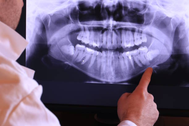 Best Emergency Root Canal Treatment in Camp Swift, TX